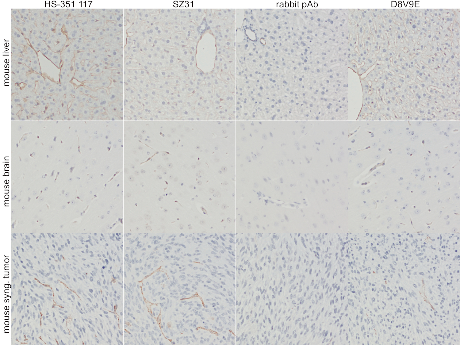 Three rows of  anti-CD31 stainings in FFPE mouse liver sections