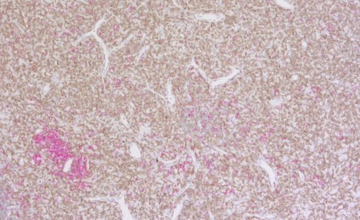 Immunohistochemical doublestaining of formalin-fixed paraffin-embedded mouse thymus using rabbit anti-mouse CD19