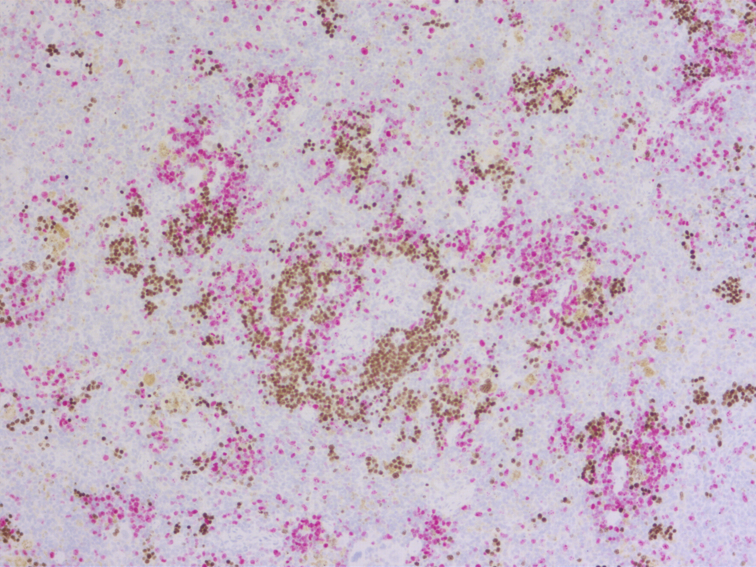 Immunohistochemical doublestaining of formalin-fixed paraffin embedded mouse spleen engrafted with human CD34+-cells using rabbit anti-human Ki67