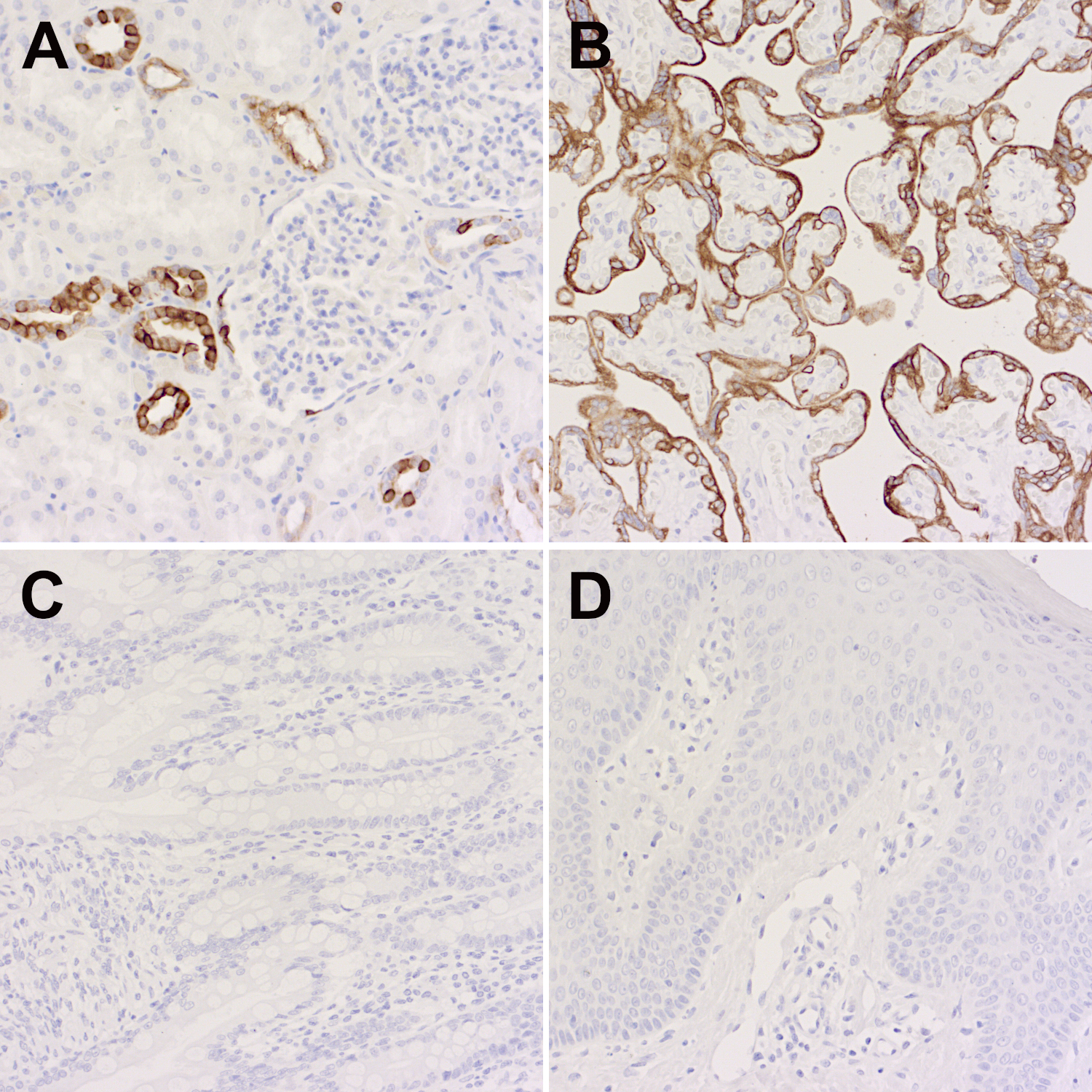 Immunohistochemical staining of formalin-fixed paraffin-embedded (FFPE) sections