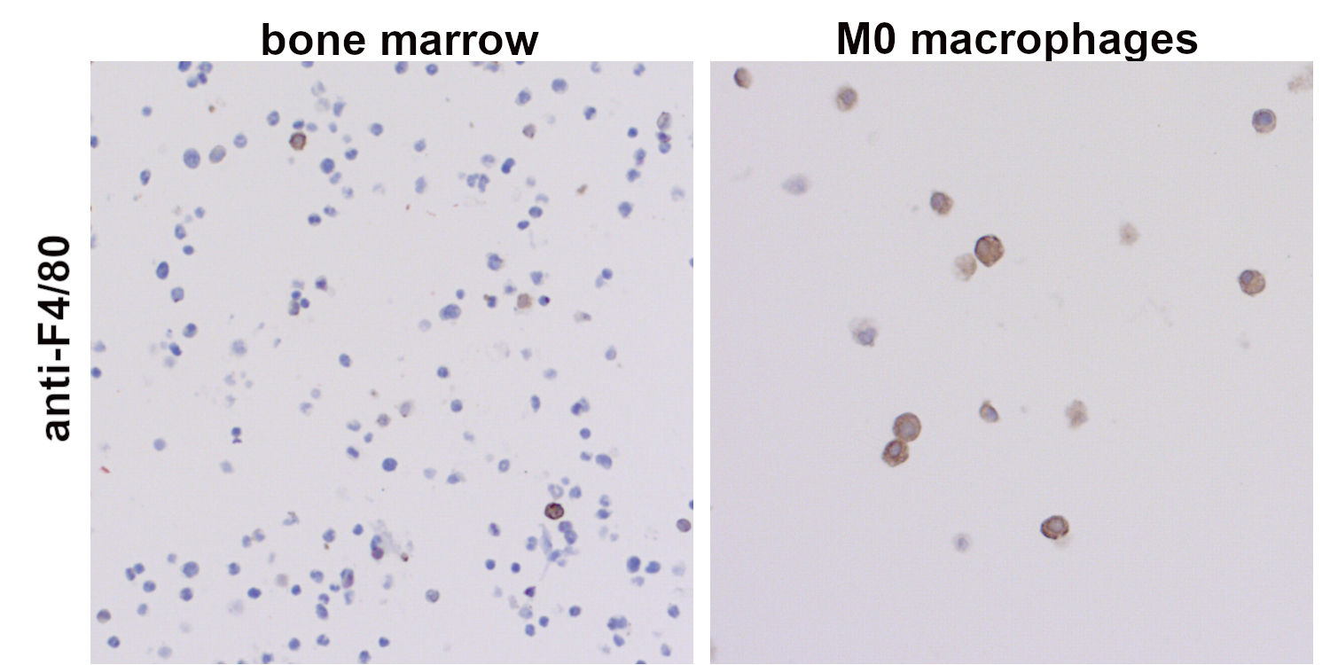 Mouse bone marrow cells and differentiated macrophages were harvested, formalin-fixed and paraffin embedded and stained with anti-F4/80.