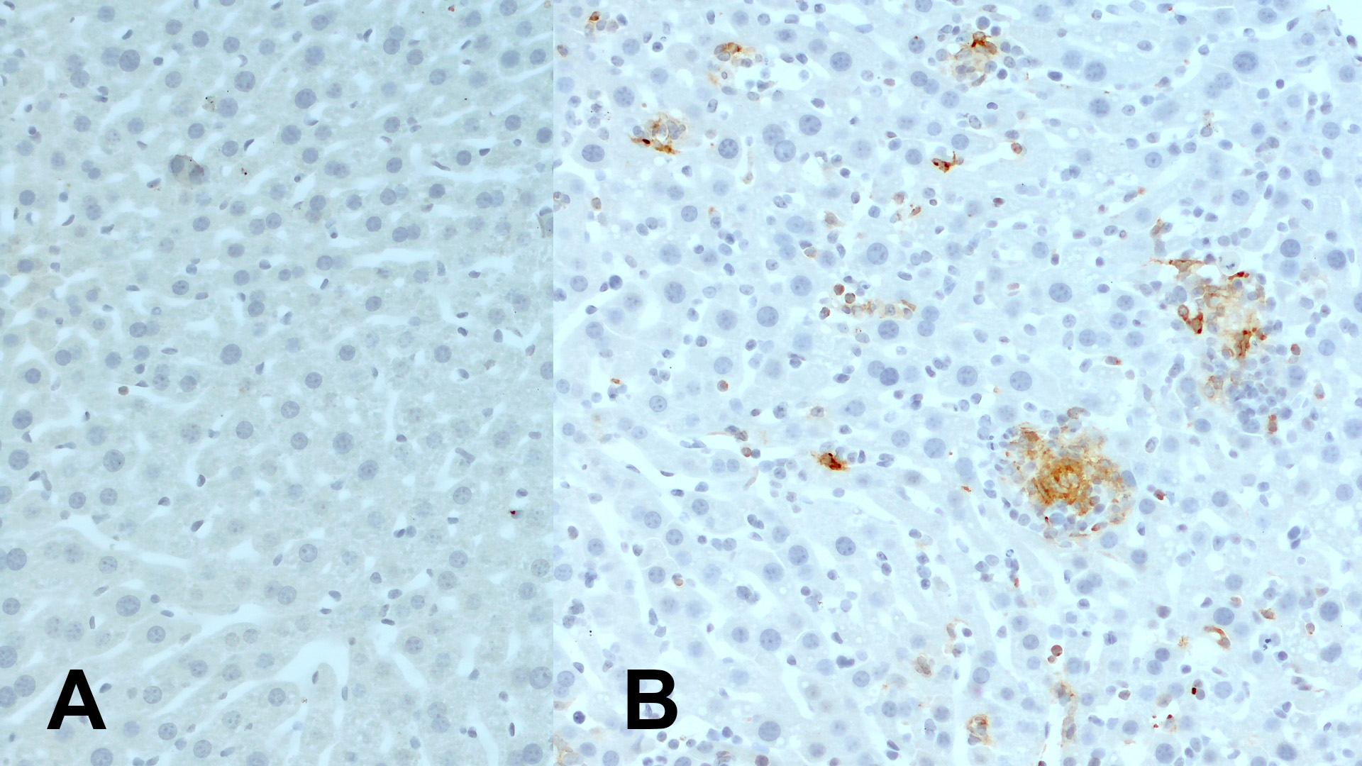 Immunohistochemical staining of FFPE mouse liver sections of A a naïve control mouse and B a mouse with systemic T. gondii infection using rabbit anti-CD11c