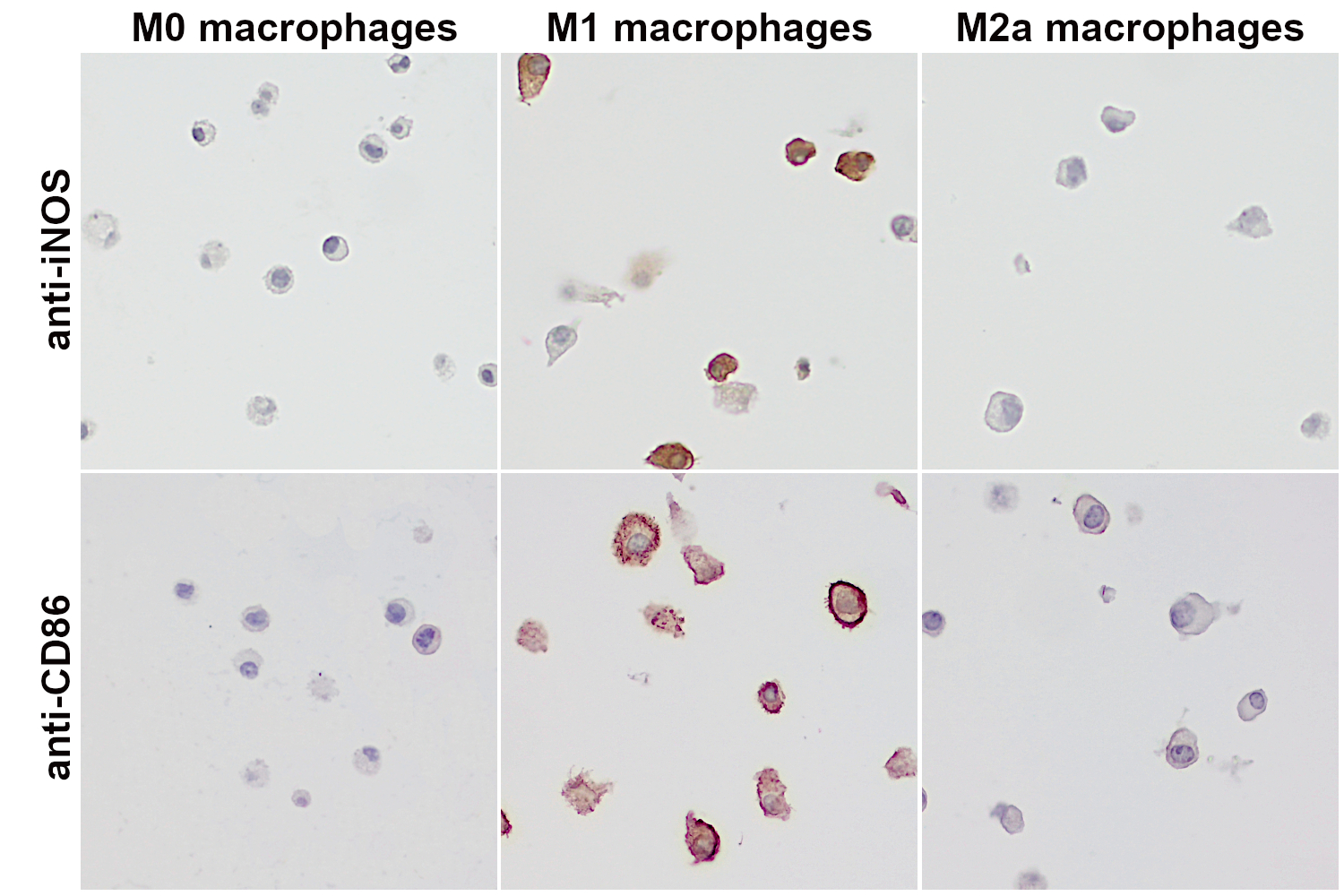 Different markers were used to monitor successful cell differentiation.