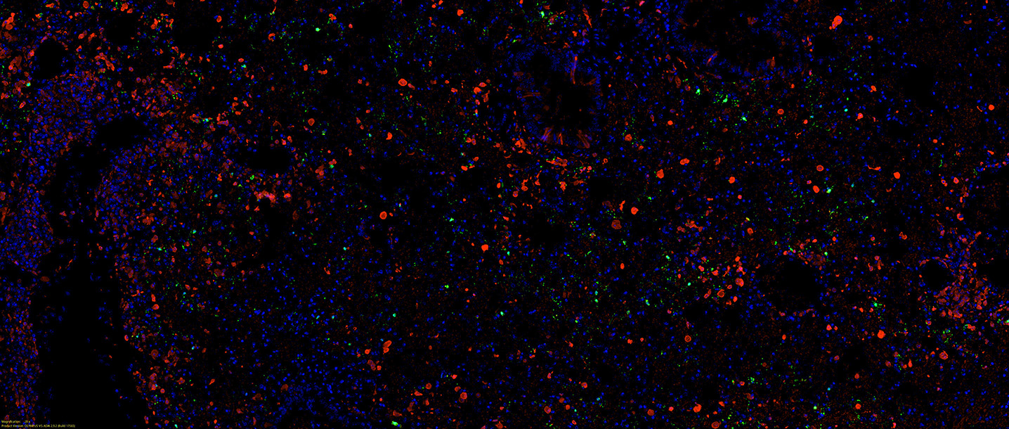 Representative image of an immunohistochemical staining of nucleocapsid CoV-1/2 (HS-452 111, green), macrophage marker MAC2 (red), and nuclei (DAPI, blue) in formalin-fixed paraffin embedded lung tissue of SARS-CoV-2 (Delta variant) infected mice.