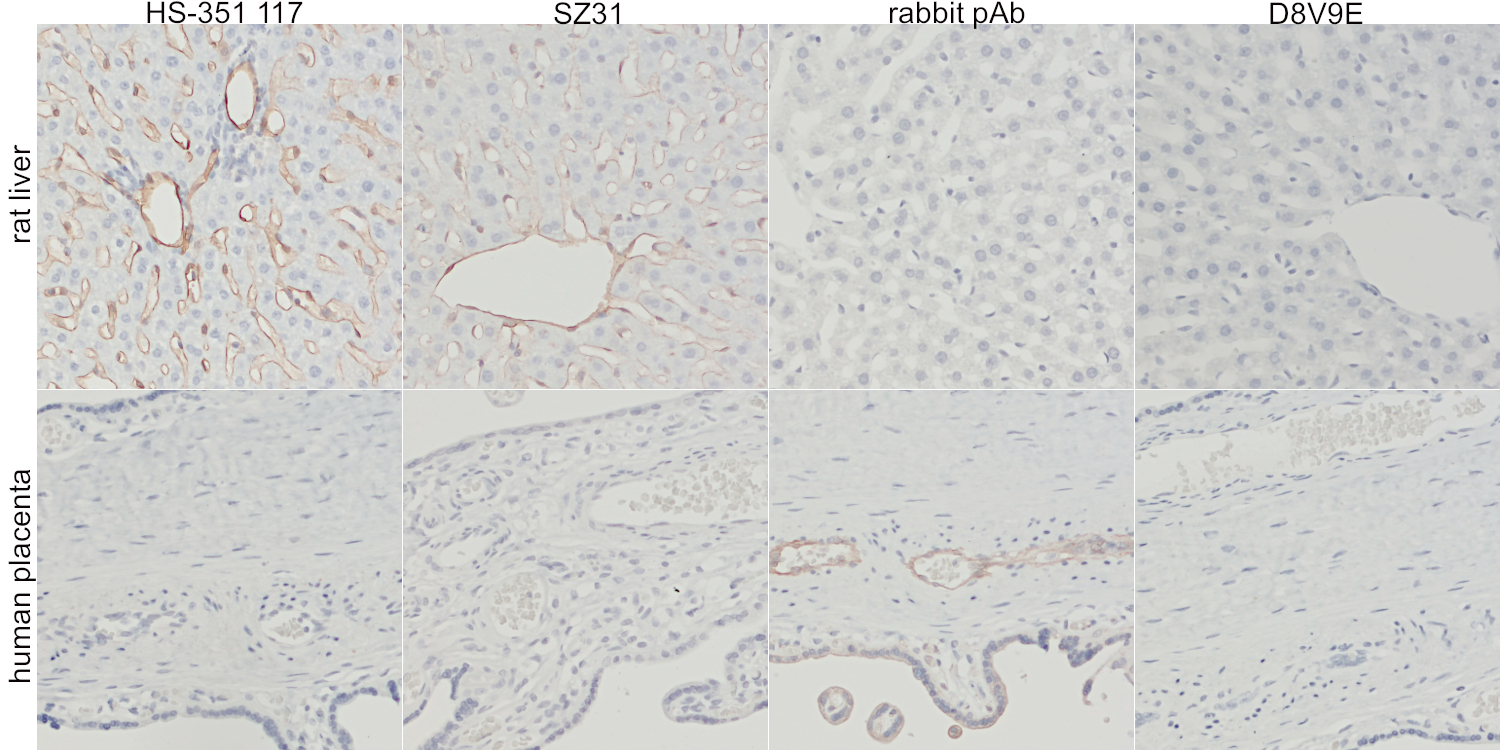 Two rows showing images of anti-CD31 stings in rat liver sections