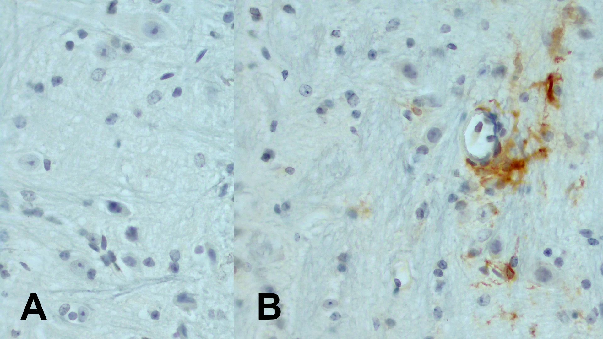Figure 5 - FFPE mouse brain section