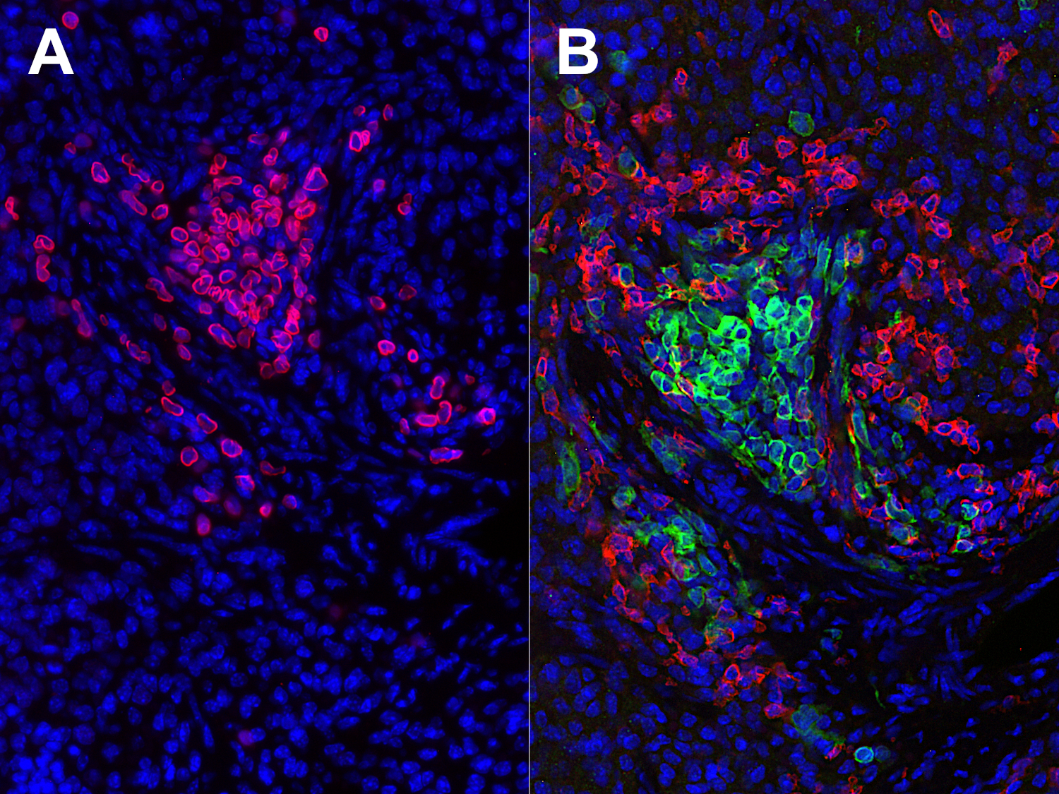 Indirect immunostaining of formalin fixed paraffin embedded sections of a humanized mouse tissue section