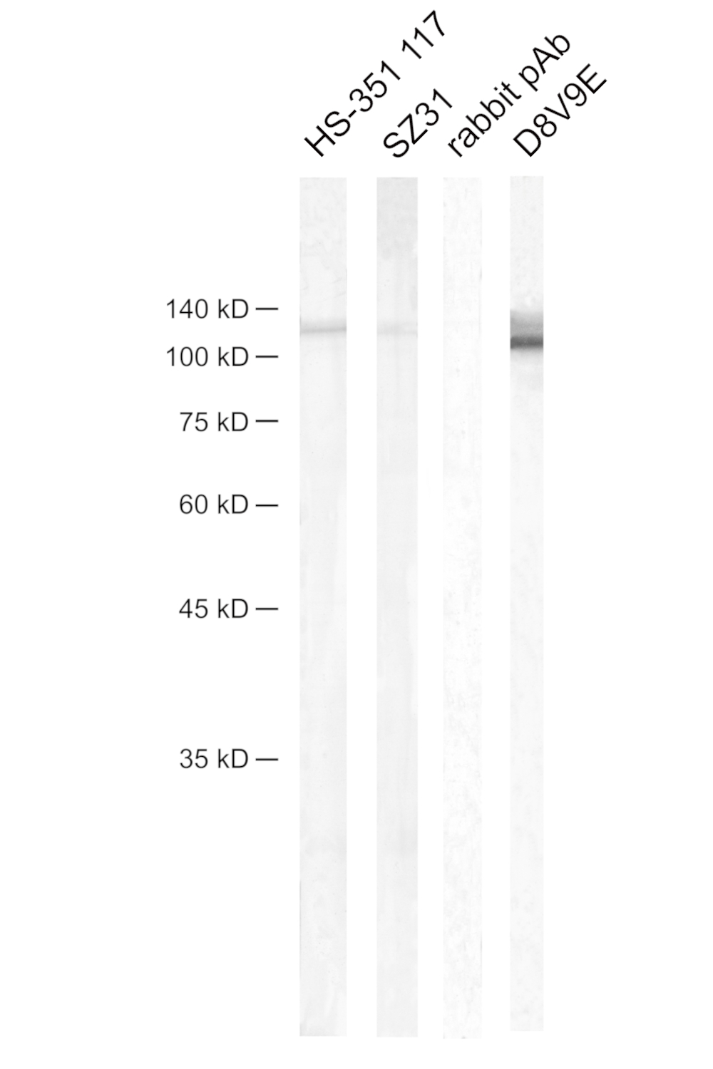 Detection of mouse CD31/PECAM 1 by Western Blot