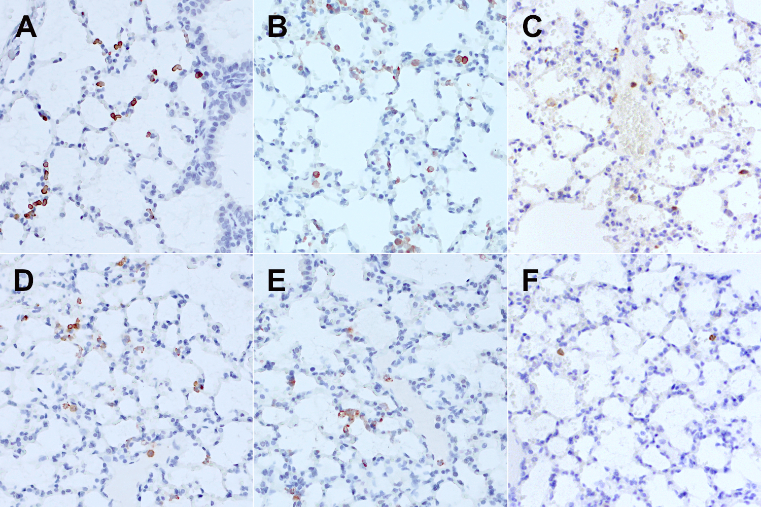 Immunohistochemical staining of formalin fixed paraffin embedded sections of a humanized mouse lung 