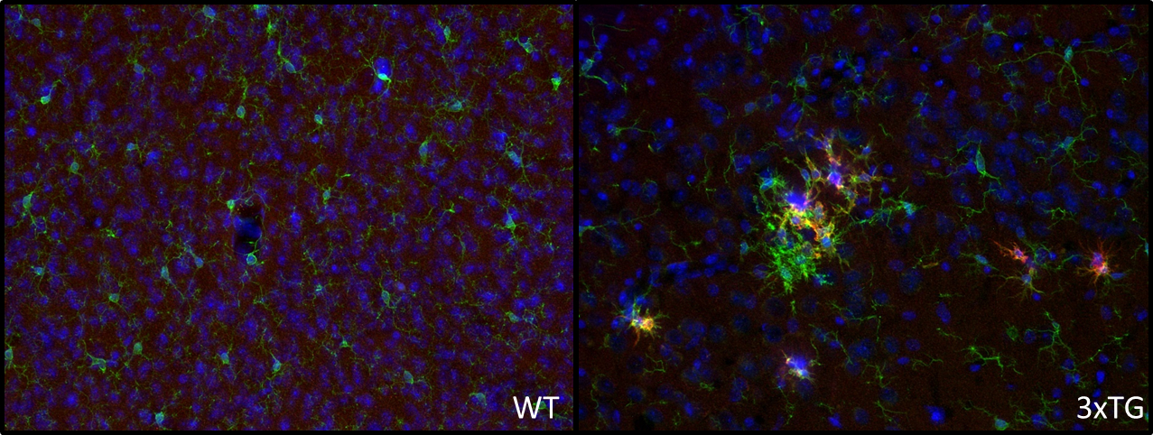 Indirect immunostaining of PFA fixed wild-type (left) and triple transgenic Alzheimer’s disease mouse (right) brain cortex sections with Guinea pig anti-CD11c 
