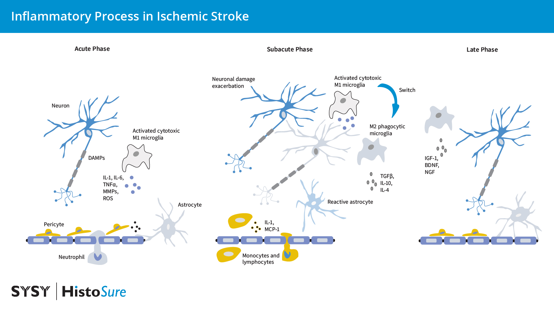 Visual graphic of a inflammatory process in ischemic stroke adapted from Jurcau and Simion