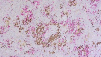 Immunohistochemical doublestaining of formalin-fixed paraffin embedded mouse spleen engrafted with human CD34+-cells using rabbit anti-human Ki67