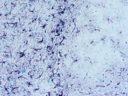 GFAP staining using  VIP in mouse brain