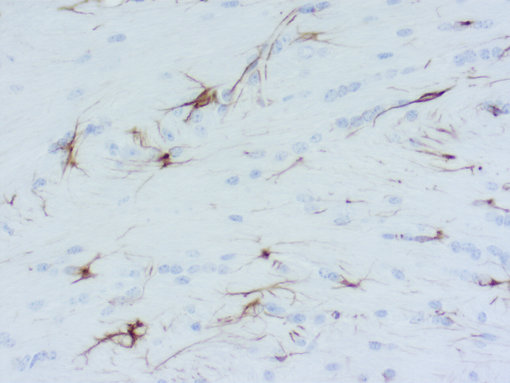 GFAP staining using DAB in mouse brain