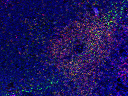 Fluorescent doublestaining of CD3e and CD4 in mouse spleen.