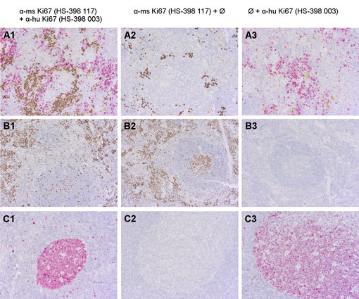 Validation of doublestaining for human- and mouse-specific Ki67 in humanized mouse spleen 