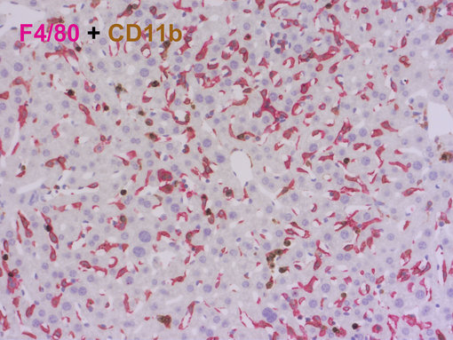 Double-staining of F4/80 and CD11b in FFPE mouse liver.