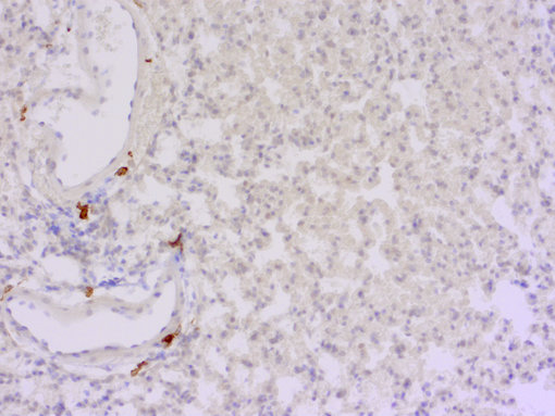 CD163 positive interstitial macrophages in FFPE mouse lung section.