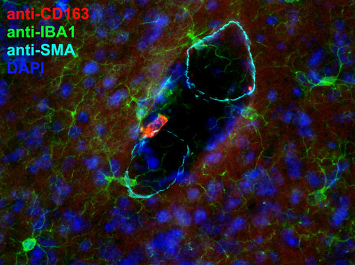 Triple-staining of CD163 and IBA1 identifies perivascular macrophages in Alpha-smooth-muscle actin stained blood vessels in PFA fixed mouse brain section.
