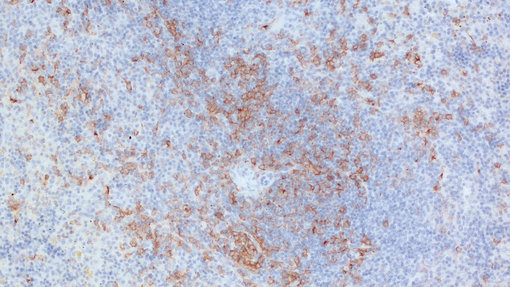 murine formalin-fixed paraffin embedded mouse spleen section with Guinea-pig anti-CD11c