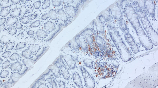 murine formalin-fixed paraffin embedded mouse colon section with rabbit anti-CD11c