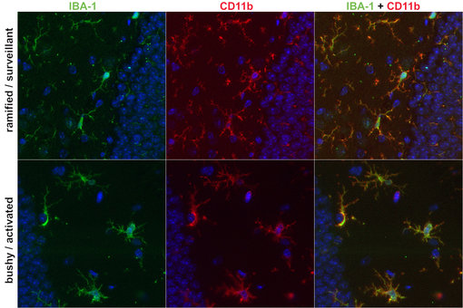 IBA-1 and CD11b staining identifies morphological changes in microglia