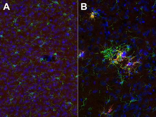  Indirect immunostaining of (A): PFA fixed wild-type and (B): triple transgenic Alzheimer’s disease mouse brain cortex sections with guinea pig anti-CD11c