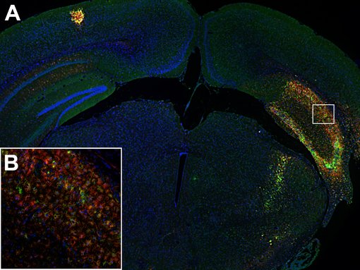 Activated microglia in the ipsilateral hippocampus of a mouse stroke brain highly express CD86 (green) and CD11b (red)