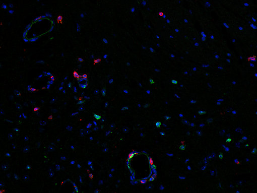 CD4 positive (red) helper T cells and CD8 positive cytotoxic T cells are detected in a mouse brain infected with Toxoplasma (T.) gondii.