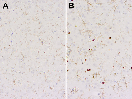 Immunohistochemical staining of formalin fixed paraffin embedded mouse brain sections from A: a non-infected PBS control mouse and B: K18-hACE2 transgenic mouse with rat anti-CD11b (cat. no. HS-384 117, dilution 1:200, DAB). Nuclei have been counterstained with haematoxylin (blue).