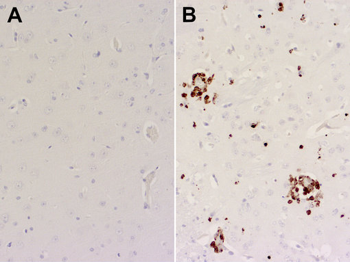 Immunohistochemical staining of formalin fixed paraffin embedded mouse brain sections from A: a non-infected PBS control mouse and B: a K18-hACE2 transgenic mouse with rat anti-Chil3 (cat. no. HS-442 017, dilution 1:200, DAB). Nuclei have been counterstained with haematoxylin (blue). 