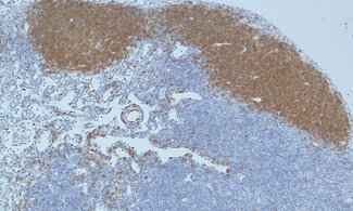 Antibody-producing B-cells are a main part of the immune system.