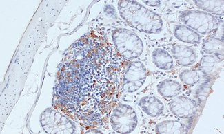 Dendritic cells act as messengers between the innate and the adaptive immune systems.