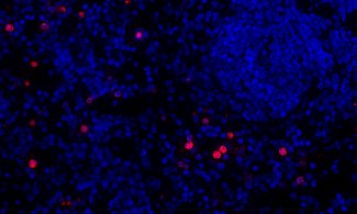 Granulocytes are innate immune cells and the most common form of leukocytes.