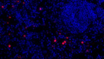 Granulocytes are innate immune cells and the most common form of leukocytes.