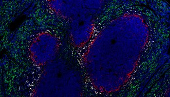 Macrophages are key players in detection and phagocytosis of pathogens, antigen presentation and cytokine release.