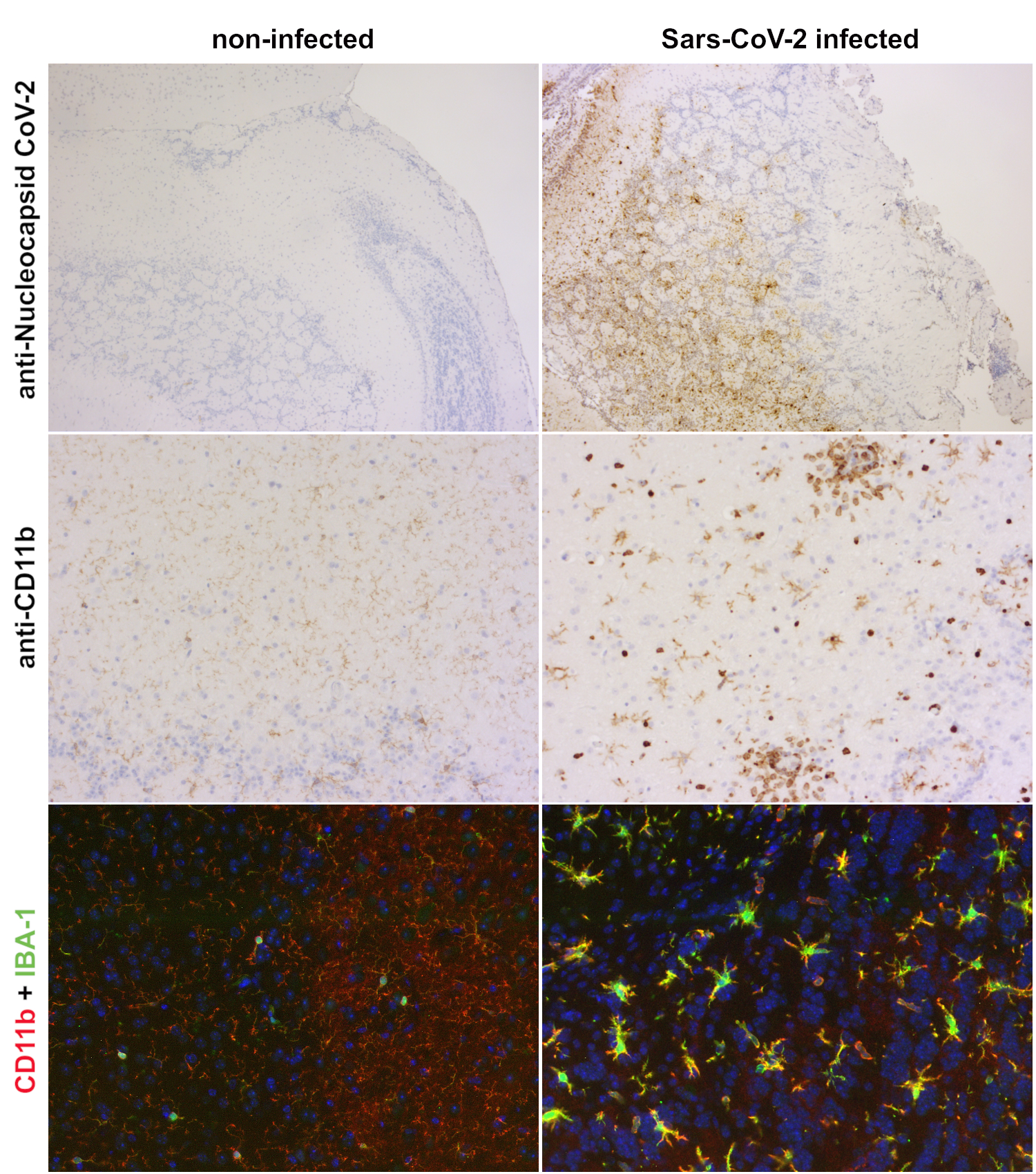Microglia activation in Sars-CoV-2 infected hACE2 transgenic mouse brain