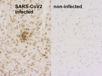 な*め様 capsuloid 41586_2008_Article_BFnature066